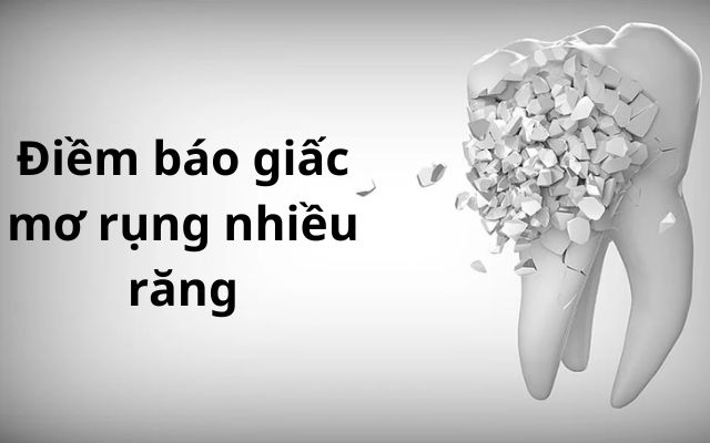 Điềm báo giấc mơ rụng nhiều răng là gì?